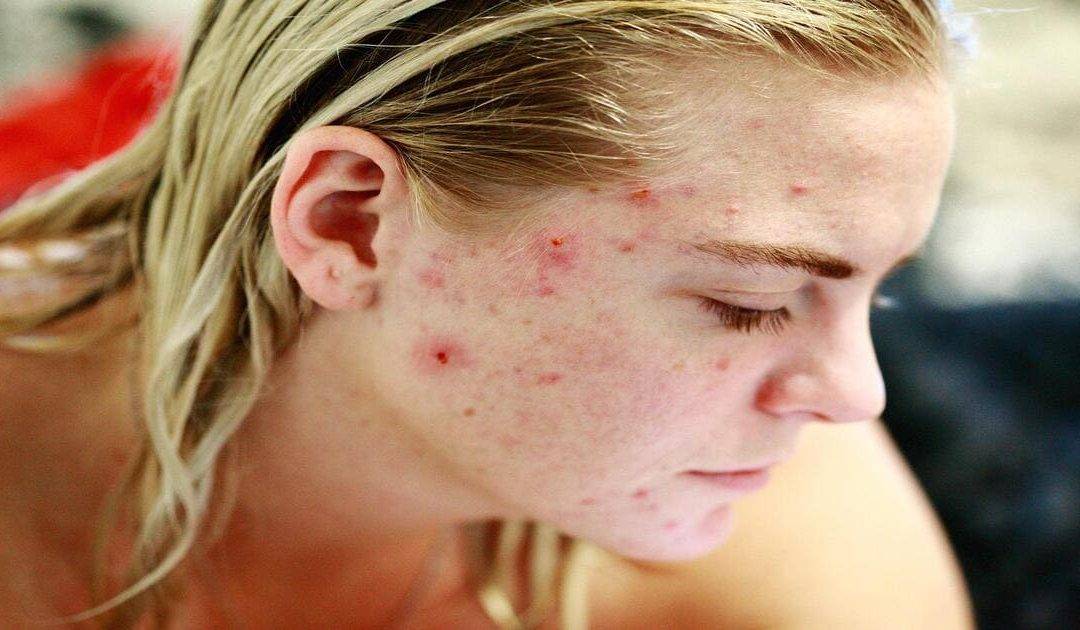 The Best Facial Cleaning & Treatment Device is the One That Improves Skin Health