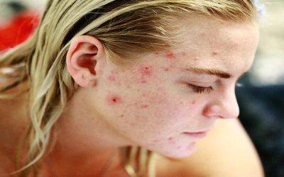 The Best Facial Cleaning & Treatment Device is the One That Improves Skin Health